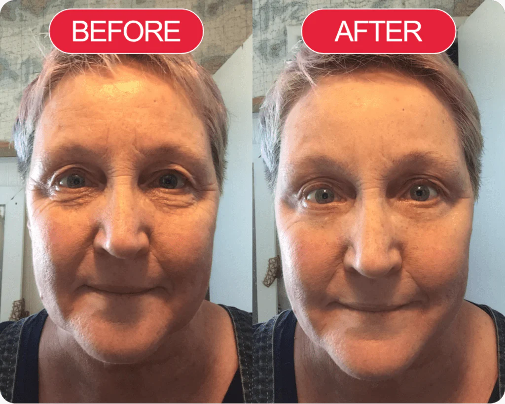 Karen before and after using TECA Skin Repair Cream